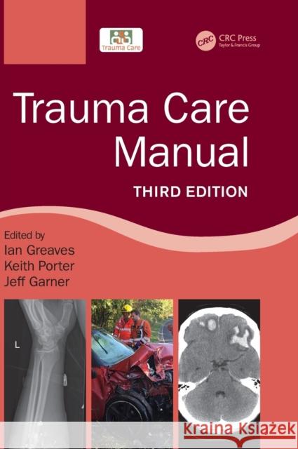 Trauma Care Manual Ian Greaves Sir Keith Porter 9781032054353
