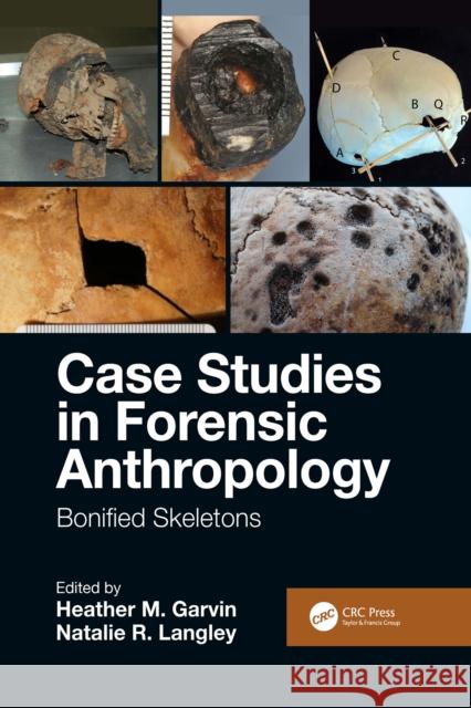 Case Studies in Forensic Anthropology: Bonified Skeletons Heather M. Garvin Natalie R. Langley 9781032086569