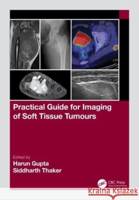 Practical Guide for Imaging of Soft Tissue Tumours  9781032111759 Taylor & Francis Ltd