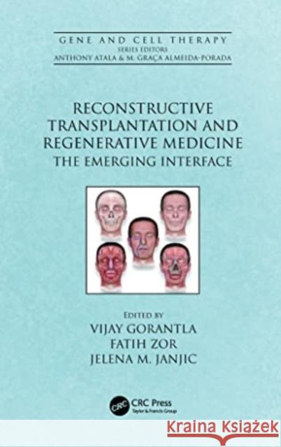 Reconstructive Transplantation and Regenerative Medicine  9781032116761 Taylor & Francis Ltd