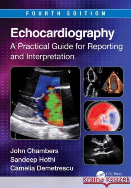 Echocardiography: A Practical Guide for Reporting and Interpretation Camelia (Guy's and St Thomas' Hospitals, London, UK) Demetrescu 9781032151588 Taylor & Francis Ltd
