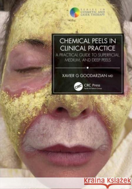 Chemical Peels in Clinical Practice Xavier G (Dr Xavier Clinic, Southampton and London, UK) Goodarzian 9781032154329 Taylor & Francis Ltd