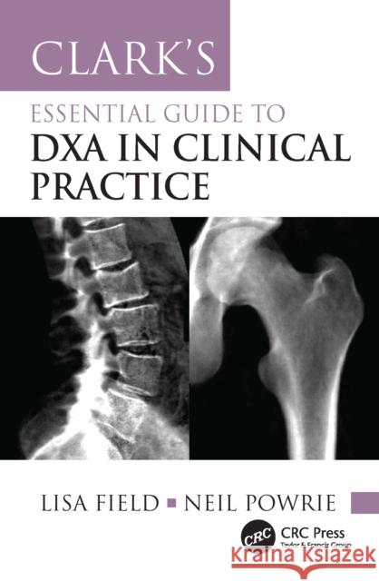 Clark's Essential Guide to DXA in Clinical Practice Neil Powrie 9781032159171 CRC Press