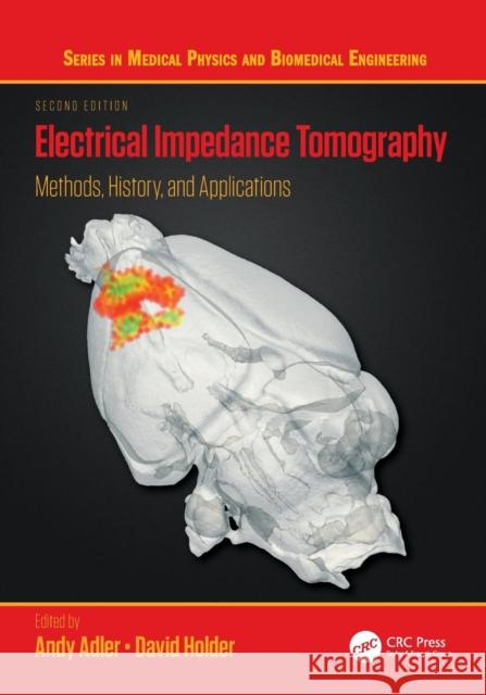 Electrical Impedance Tomography: Methods, History and Applications Andy Adler David Holder 9781032161174 CRC Press