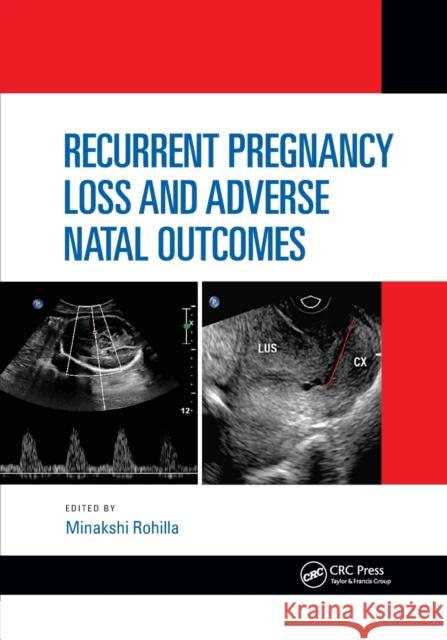 Recurrent Pregnancy Loss and Adverse Natal Outcomes Minakshi Rohilla 9781032173481 CRC Press