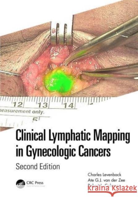 Clinical Lymphatic Mapping in Gynecologic Cancers Charles Levenback Ate Gj Va Robert L. Coleman 9781032186436