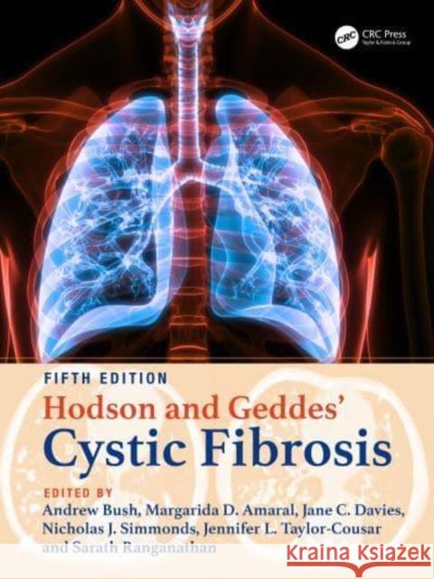 Hodson and Geddes' Cystic Fibrosis  9781032202204 Taylor & Francis Ltd