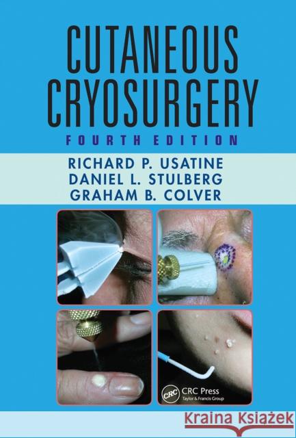 Cutaneous Cryosurgery: Principles and Clinical Practice Usatine, Richard P. 9781032243023