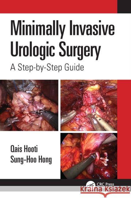 Minimally Invasive Urologic Surgery: A Step-By-Step Guide Qais Hooti Sung-Hoo Hong 9781032257105