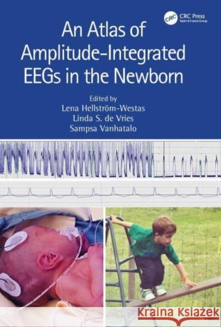 An Atlas of Amplitude-Integrated Eegs in the Newborn Linda S. d Lena Hellstr?m-Westas Sampsa Vanhatalo 9781032258508 CRC Press