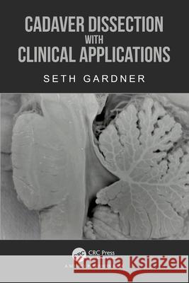 Cadaver Dissection with Clinical Applications Seth (Lake Erie College of Osteopathic Medicine, USA) Gardner 9781032270036