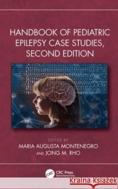 Handbook of Pediatric Epilepsy Case Studies Maria Augusta Montenegro Jong M. Rho 9781032283586 CRC Press