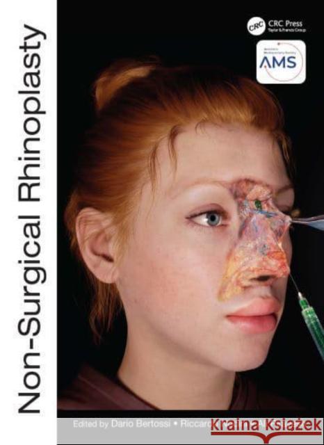 Non-Surgical Rhinoplasty  9781032303444 Taylor & Francis Ltd