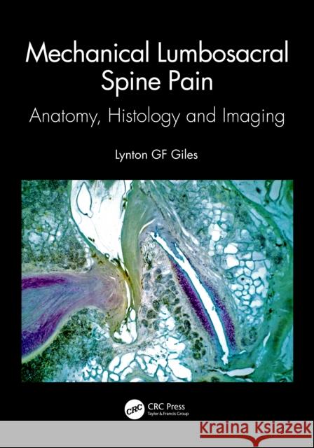 Mechanical Lumbosacral Spine Pain: Anatomy, Histology and Imaging Giles, Lynton Gf 9781032326436 Taylor & Francis Ltd