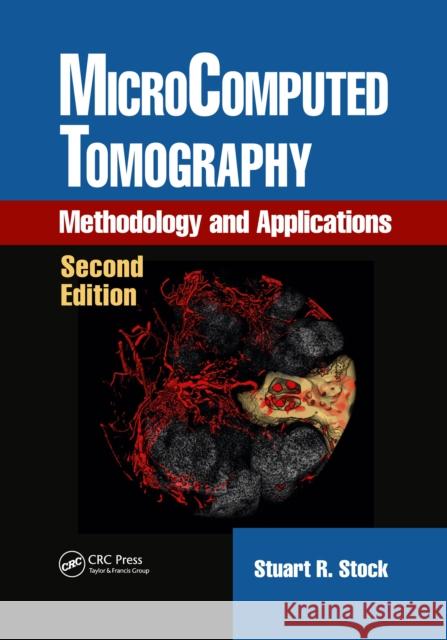 Microcomputed Tomography: Methodology and Applications, Second Edition Stuart R. Stock 9781032337388