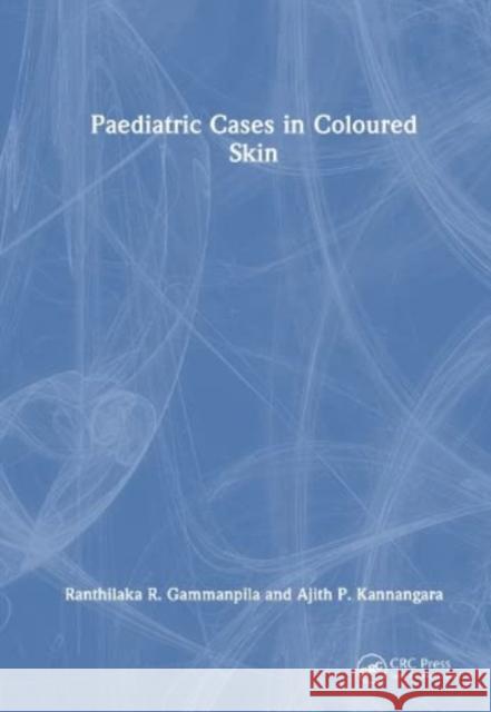 Paediatric Cases in Coloured Skin Ajith P. (Teaching Hospital Karapitiya, Sri Lanka) Kannangara 9781032343167 Taylor & Francis Ltd