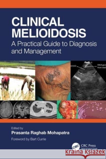 Clinical Melioidosis: A Practical Guide to Diagnosis and Management Raghab Mohapatra, Prasanta 9781032348278 Taylor & Francis Ltd