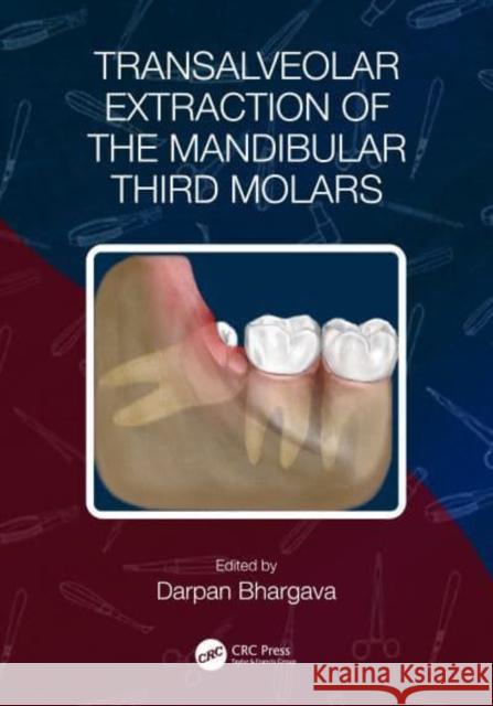 Transalveolar Extraction of the Mandibular Third Molars  9781032348315 Taylor & Francis Ltd