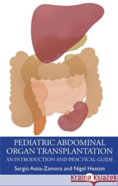 Pediatric Abdominal Organ Transplantation Nigel (King's College Hospital) Heaton 9781032377568 Taylor & Francis Ltd