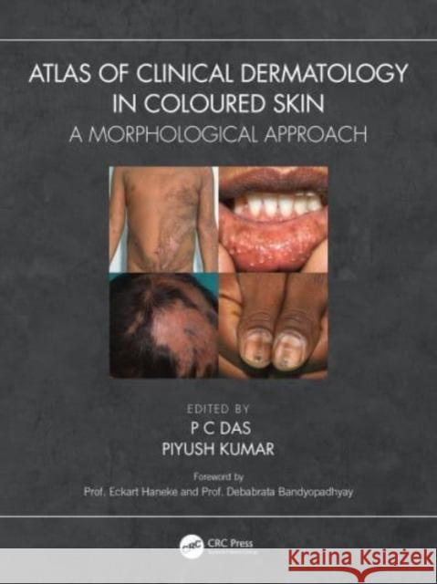 Atlas of Clinical Dermatology in Coloured Skin: A Morphological Approach  9781032399669 Taylor & Francis Ltd