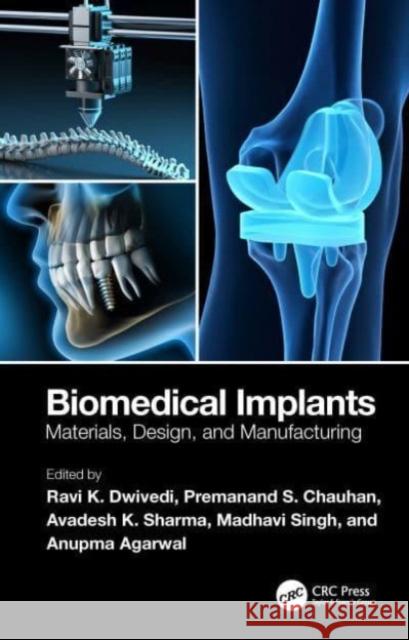 Biomedical Implants  9781032428406 Taylor & Francis Ltd