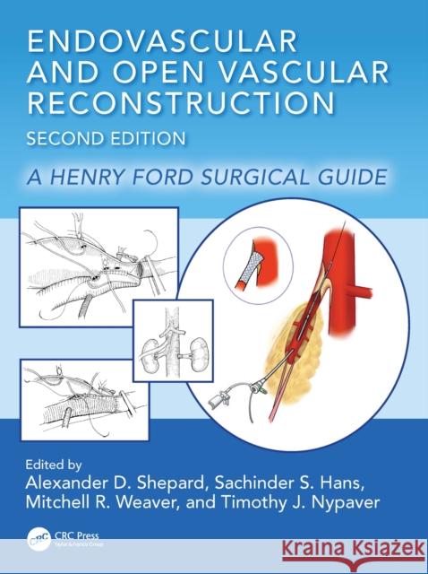 Endovascular and Open Vascular Reconstruction: A Henry Ford Surgical Guide Alexander Shepard Sachinder Singh Hans Mitchell Weaver 9781032433776