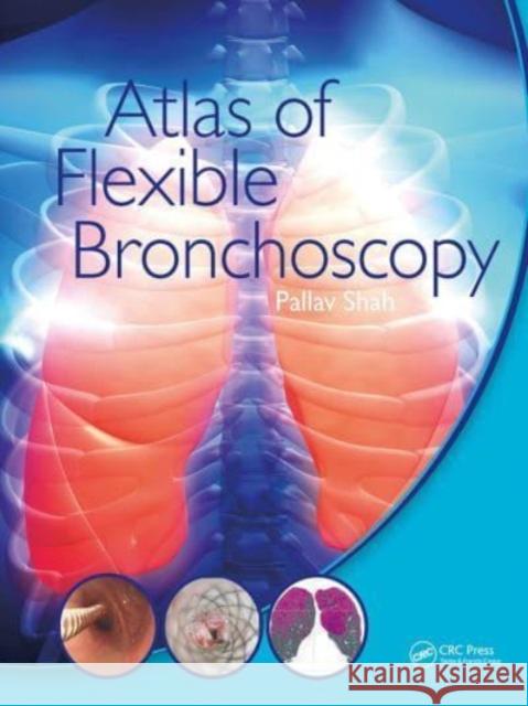 Atlas of Flexible Bronchoscopy Pallav Shah 9781032477589