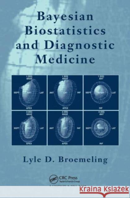 Bayesian Biostatistics and Diagnostic Medicine Lyle D. Broemeling 9781032477831 CRC Press