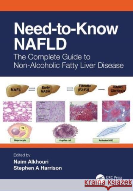 Need-to-Know NAFLD: The Complete Guide to Non-Alcoholic Fatty Liver Disease Naim Alkhouri Stephen A. Harrison 9781032479484 Taylor & Francis Ltd
