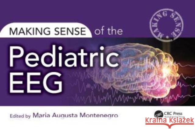 Making Sense of the Pediatric EEG Maria Montenegro 9781032486079 Taylor & Francis Ltd