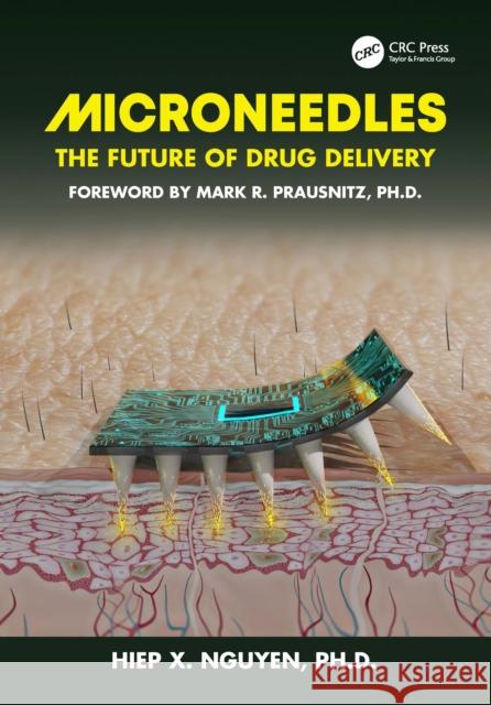 Microneedles: The Future of Drug Delivery Hiep Xuan Nguyen 9781032514086