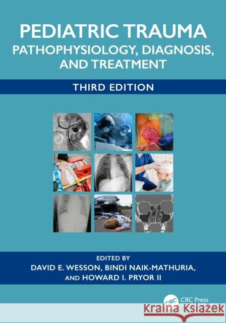 Pediatric Trauma: Pathophysiology, Diagnosis, and Treatment  9781032547244 CRC Press