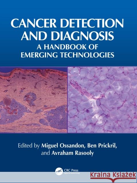 Cancer Detection and Diagnosis: A Handbook of Emerging Technologies Miguel Ossandon Ben Prickril Avraham Rasooly 9781032577012 CRC Press