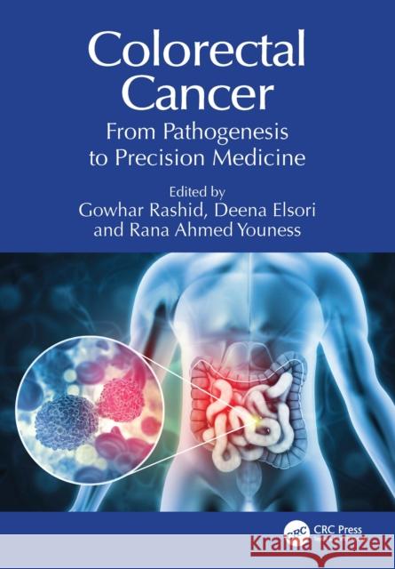 Colorectal Cancer: From Pathogenesis to Precision Medicine Gowhar Rashid Deena H. Elsori Rana Ahmed Youness 9781032699653