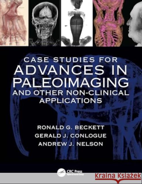 Case Studies for Advances in Paleoimaging and Other Non-Clinical Applications Ronald G. Beckett Gerald J. Conlogue Andrew Nelson 9781032729299 CRC Press