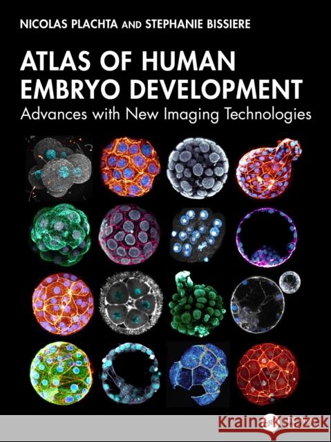 Atlas of Human Embryo Development: Advances with New Imaging Technologies Stephanie Bissiere 9781032751474 CRC Press