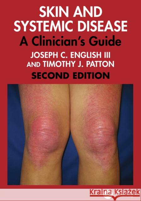 Skin and Systemic Disease: A Clinician's Guide Timothy J. Patton 9781032762814