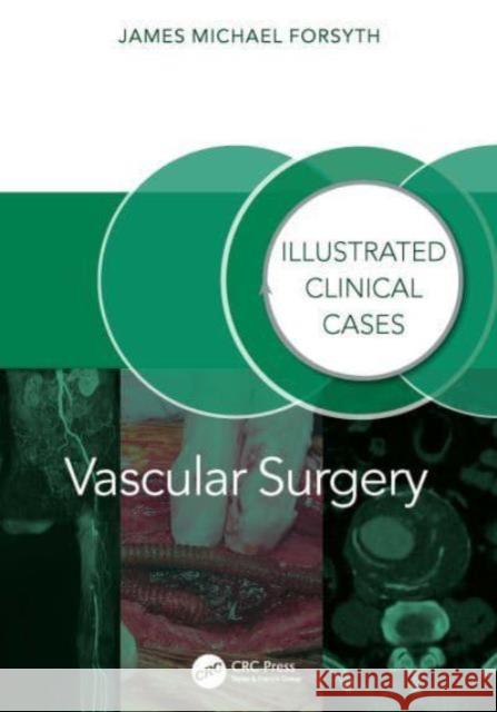 Vascular Surgery: James Forsyth 9781032804811