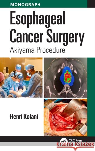 Esophageal Cancer Surgery: Akiyama Procedure Henri Kolani 9781032805825 CRC Press