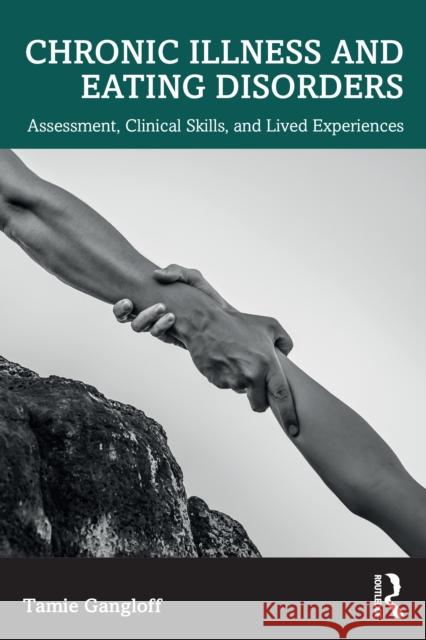 Chronic Illness and Eating Disorders: Assessment, Clinical Skills, and Lived Experiences Tamie Gangloff 9781032812267 Routledge