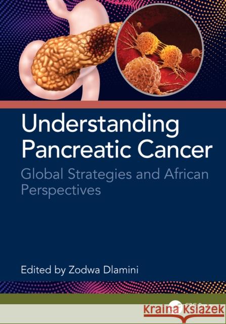 Understanding Pancreatic Cancer: Global Strategies and African Perspectives Zodwa Dlamini 9781032897479 CRC Press