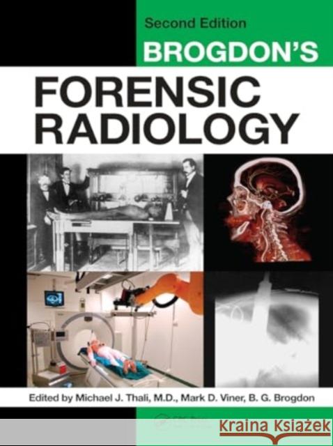 Brogdon's Forensic Radiology Michael J. Thali Mark D. Viner B. G. Brogdon 9781032917931 CRC Press