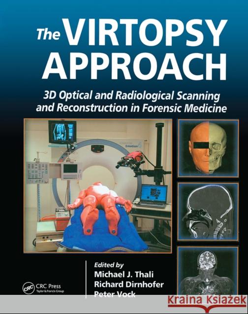 The Virtopsy Approach: 3D Optical and Radiological Scanning and Reconstruction in Forensic Medicine Michael Thali Richard Dirnhofer Peter Vock 9781032918884 CRC Press
