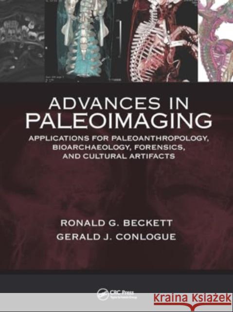 Advances in Paleoimaging: Applications for Paleoanthropology, Bioarchaeology, Forensics, and Cultural Artifacts Gerald J. Conlogue Ronald G. Beckett 9781032923284 CRC Press