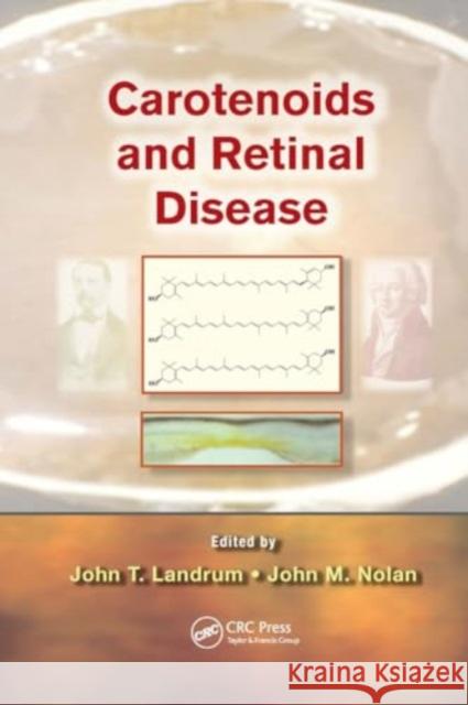 Carotenoids and Retinal Disease John T. Landrum John Nolan 9781032924151 CRC Press