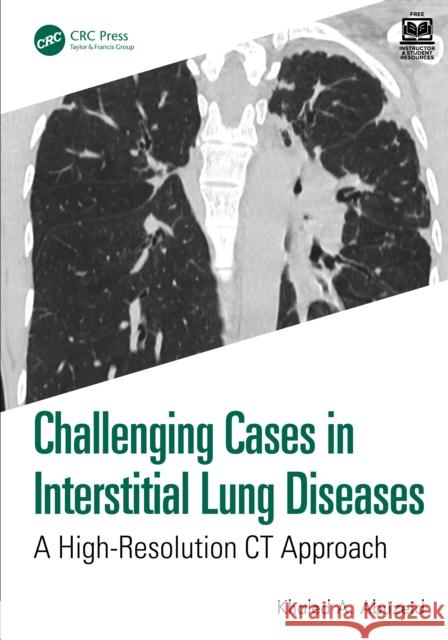 Challenging Cases in Interstitial Lung Diseases: A High-Resolution CT Approach Khaled A. Abuzeid 9781032950051 CRC Press