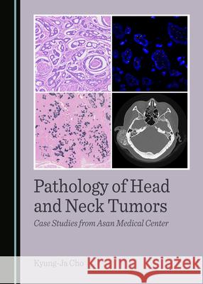 Pathology of Head and Neck Tumors: Case Studies from Asan Medical Center Kyung-Ja Cho 9781036407353 Cambridge Scholars Publishing