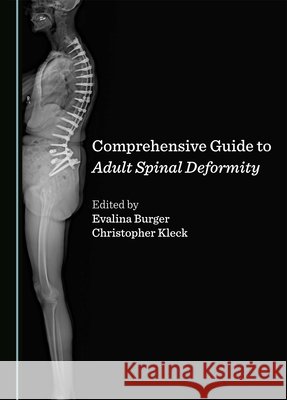 Comprehensive Guide to Adult Spinal Deformity Evalina Burger Christopher Kleck 9781036408558 Cambridge Scholars Publishing