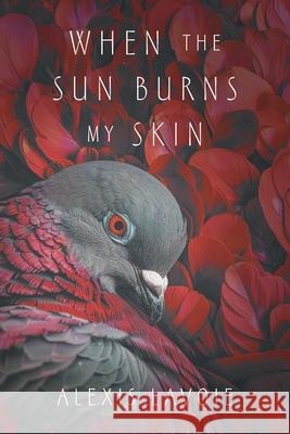 When the Sun Burns My Skin Alexis Lavoie 9781038334329 FriesenPress