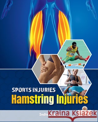 Hamstring Injuries India James 9781039880788